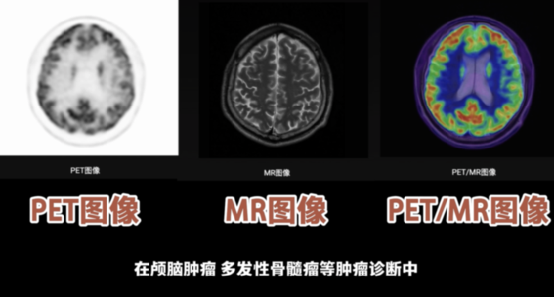 【晒晒咱的国之重器13】短视频丨全能影像诊断设备：一体化PET/MR